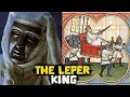 The Leper King - Baldwin IV of Jerusalem