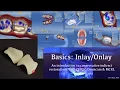 Basics of Inlays and Onlays - Conservative Indirect Restoration with CEREC Omnicam and MCXL