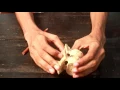 Lumber vertebrae