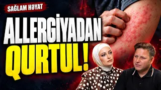 Allergiyadan birdəfəlik qurtulmaq istəyənlər, MÜTLƏQ BAXIN! | Sağlam Həyat | Gülnar Quliyeva
