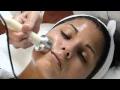Download Lagu Ultra Scrubber and Ultra Sonic Wave System - Application \u0026 Procedure