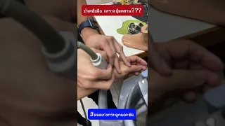  อาการปวดที่ข้อมือและบวมบริเวณนิ้วโป้งเกิดจากสาเหตุอะไร 