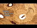 Histology Compact Bone Osseous Tissue
