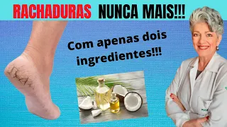 Acabe com As Rachaduras nos Pés em Casa e Gastando Pouco