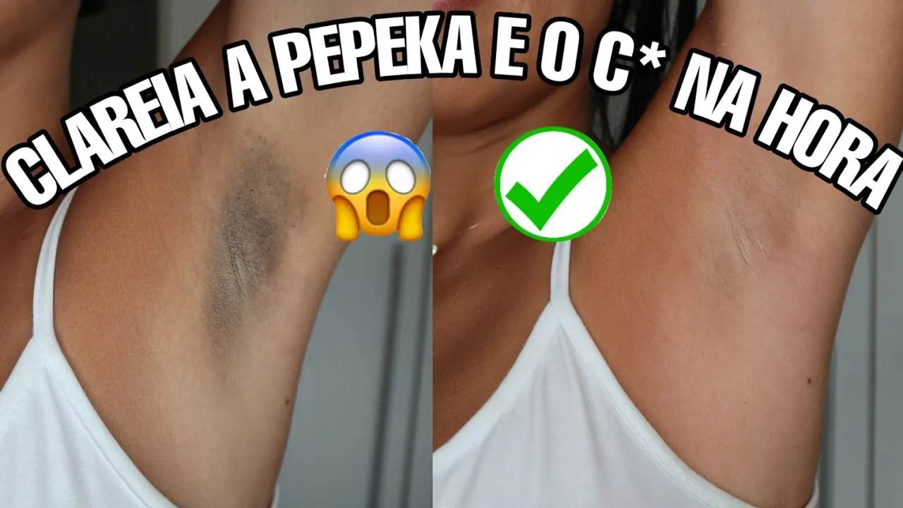O MELHOR PEELING CASEIRO | MELHORA CRAVOS, MANCHAS E ESPINHAS