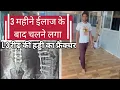 Download Lagu L3 spinal cord fracture started walking after 3 months of treatment SSpinal cord injury Recovery