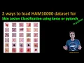 202 - Two ways to read HAM10000 dataset into python for skin cancer lesion classification