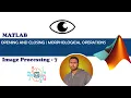 Opening Closing Digital Image Processing 7 MATLAB