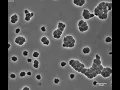 Cholera bacteria can survive antibiotics for a time by turning into globs