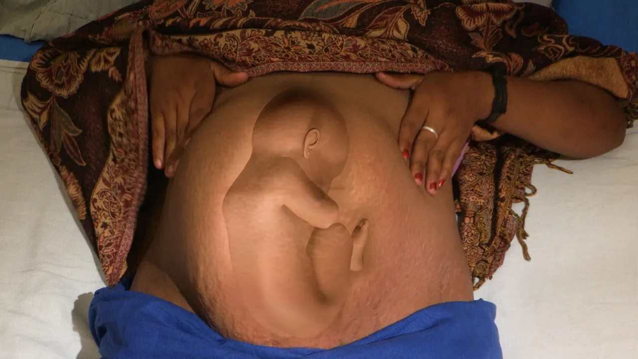 The Breech Birth - Childbirth Series