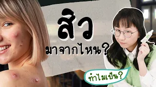 หากเป็นสิวแบบรุนแรงควรทำอย่างไร