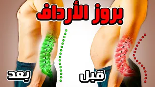 علاج بروز المؤخره عند الرجال والنساء تخلص من اللوردوس لزياده الطول 