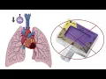 End Tidal CO2 in Cardiac Arrest