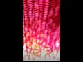 Does Hydrogen Explode or Implode