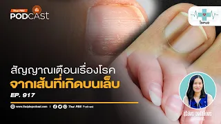 ทำไมการสังเกตเล็บจึงสำคัญต่อสุขภาพโดยรวม