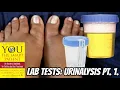 LAB TESTS URINALYSIS PT 1 SMART PATIENT
