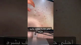 تنظيف البشرة بعمق 