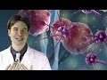 FEBRE REUMÁTICA- O QUE É E COMO SE PREVENIR DESTA DOENÇA
