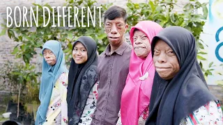 the family whose faces change shape born different