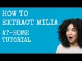 Shirley Says How To Extract Milia - At-Home Tutorial