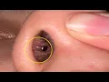 how to get rid of a piercing bump inside your nose naturally