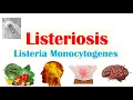 Download Lagu Listeriosis (Listeria Monocytogenes) | Sources, Pathophysiology, Symptoms, Diagnosis, Treatment