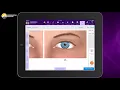 Documenting an Eye Exam in Our Ophthalmology EHR EMA