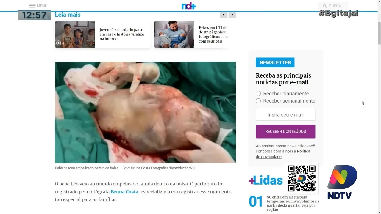 Em parto raro, bebê nasce dentro da bolsa amniótica em Balneário Camboriú