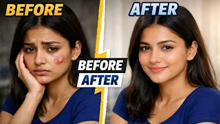 🌿Ringworm removal tips🌴Daad, Khaj, Khujli, ringworm paste, permanently solution for ringworm, remedy