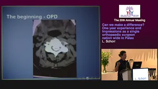 Day 1 11 Can We Make A Difference L Schorr 