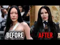 We re BEGGING These Celebrities To Dissolve Their Filler