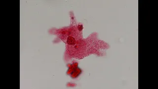 Protists A Taxonomic Mess