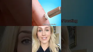 Doctor reacts freezing a wart zackdfilms