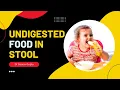 Undigested food particles in stool