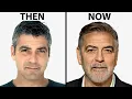 George Clooney s NEW FACE Plastic Surgery Analysis