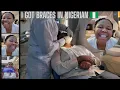 Download Lagu I FINALLY DID IT !! COME GET MY BRACES WITH ME / WHAT COLOR + WHAT I ATE + PAIN LEVEL AND MORE…
