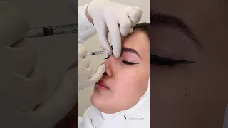 كيف صغرنا حجم الأنف 