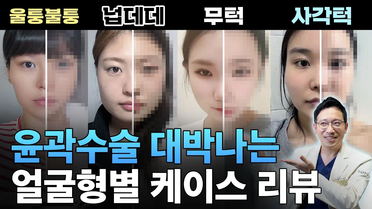 이런분들은 윤곽수술 하시면 대박납니다🎊
