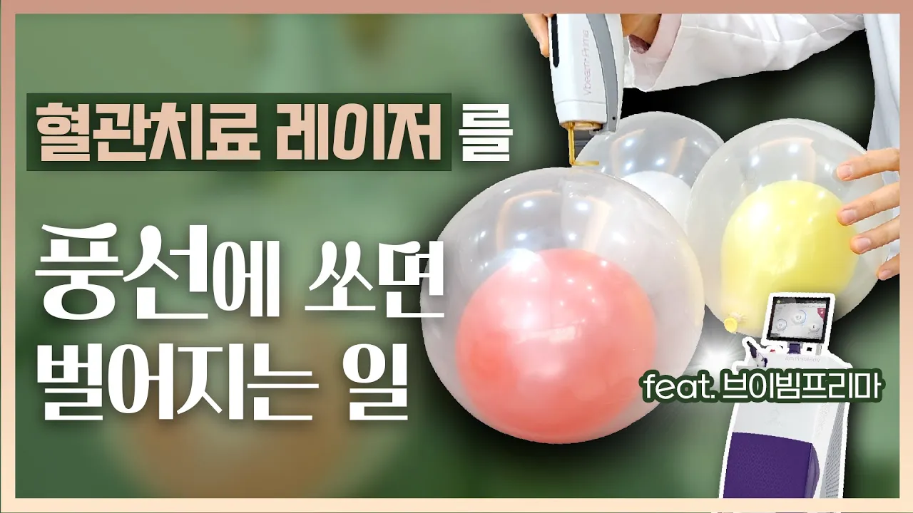 선택적 혈관치료 레이저(브이빔프리마)의 치료 원리! (feat.풍선실험)