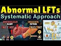Abnormal Liver Function Tests LFTs How to Interpret Abnormal Liver Function Tests with Examples