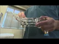 Synthetic Toe Could Be New Solution For Old Problem