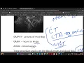 14TH CLASS RADIOLOGY Radiology in Medical Coding Explained CPT Codes Modifiers CPC Preparation