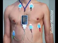 Electrocardiographic recording CPT code - simplify medical coding