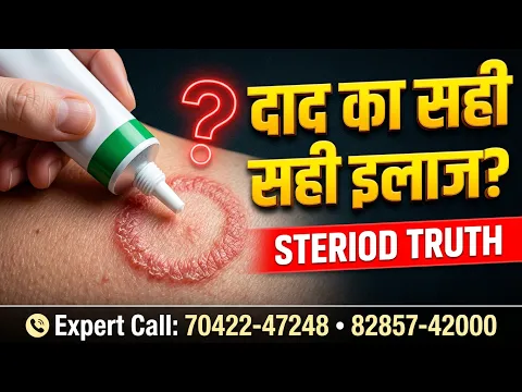 यही क्रीम दाद बढ़ा रही? फंगल इंफेक्शन कितने दिन में ठीक होता है | Steroid Cream का सच — video thumbnail