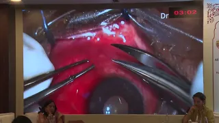 AIOC2026 FP1558 Dr Jay Oswal From Shadows to Clarity Ultrasound Biomicroscopy UBM in the Diagno
