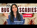 Is It Scabies OR Bed Bugs OR Lice How to Tell the Difference Doctor Explains