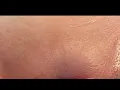 Download Lagu Brazilian Waxing no irritation: Inner thighs