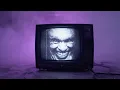 Static in my smile