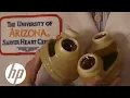 Download Lagu Living With an Artificial Heart | HP Matter | HP