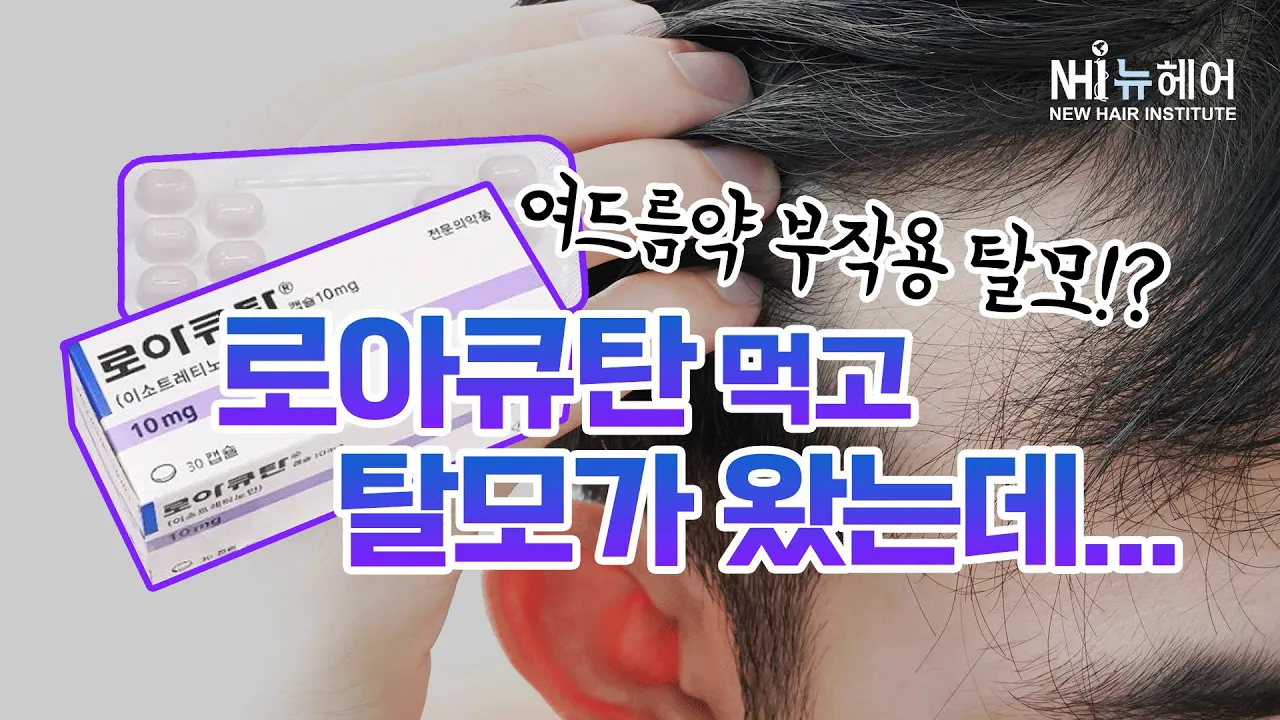 로아큐탄 부작용이 탈모? l 여드름약 탈모 l 뉴헤어